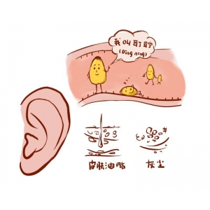 耳朵里耳屎多，到底要不要掏，正确处理方式是？