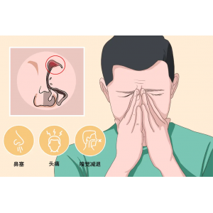 鼻窦炎不是小病，拖延治疗，当心三大并发症！