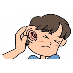 耳朵瘙痒、红肿，外耳道湿疹不可小觑
