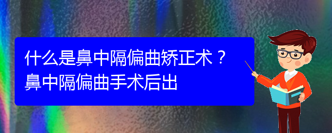 (贵阳鼻科医院挂号)什么是鼻中隔偏曲矫正术？ 鼻中隔偏曲手术后出(图1)