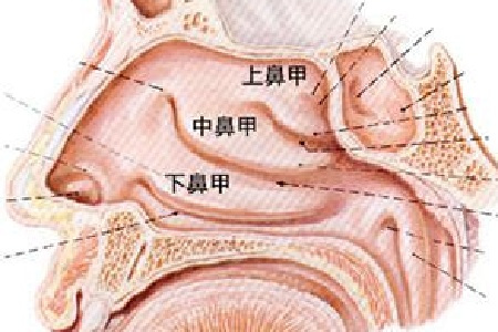 (贵阳哪个医院对鼻中隔偏曲治疗较好)贵阳哪个医院看鼻最好(图2)