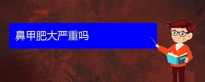 (贵阳鼻甲肥大的治疗费用)鼻甲肥大严重吗(图1)