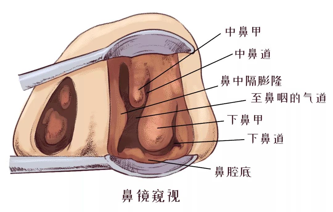 鼻甲肥大引起的呼吸困难怎么办？(图2)