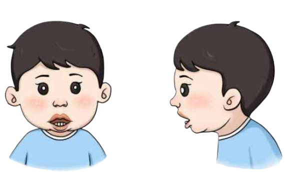 孩子打呼噜是睡得香？注意可能是鼾症惹的祸(图2)