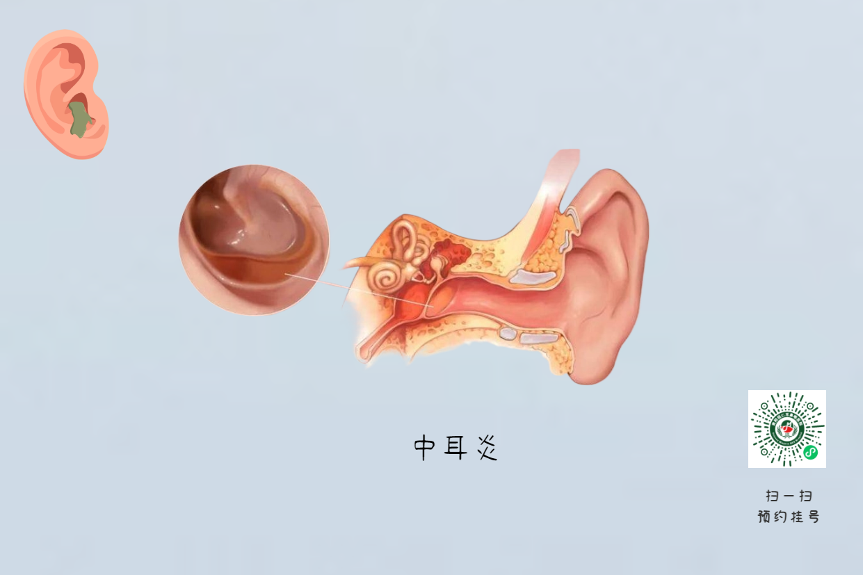 手术没做干净，术后3年颅内竟发现巨大胆脂瘤！(图4)