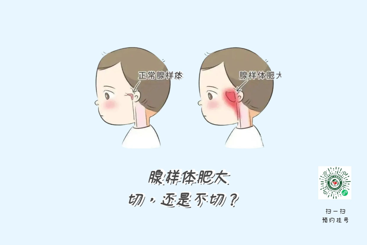 暑假来了，孩子腺样体肥大到底切不切？(图1)