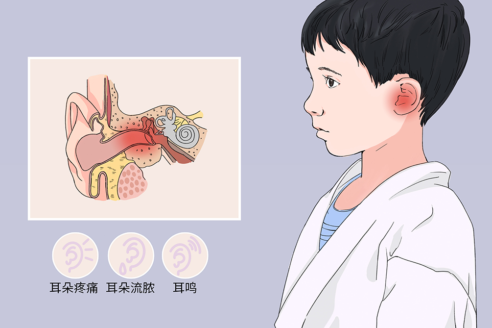 中耳炎虽小，但其危害不容小觑！(图1)