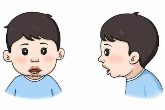 专家分享：父母注意！孩子腺样体肥大如果忽略，后果很严重！(图2)