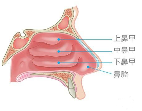 鼻甲肥大会引起面部结构变化，还会导致眼袋、黑眼圈？(图1)