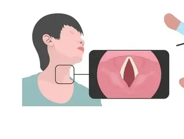耳鼻喉分享：嘶哑声不一定是上火，要警惕这些疾病！(图3)