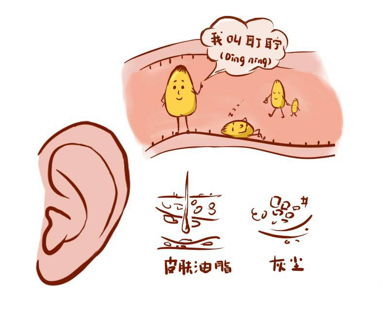 关于中耳炎的5个常见问题，你一定要知道！(图2)