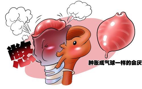 会厌囊肿并非小毛病，严重会引起窒息？(图1)