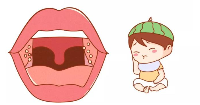 切除扁桃体会对身体产生危害吗？(图3)