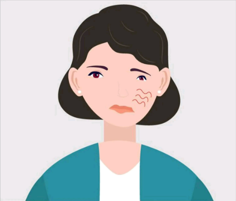 中耳炎会引起面瘫，是真的吗？(图3)