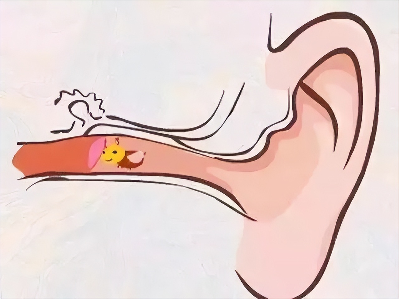 耳鸣耳聋，千万别大意，勿让小病变大病(图2)