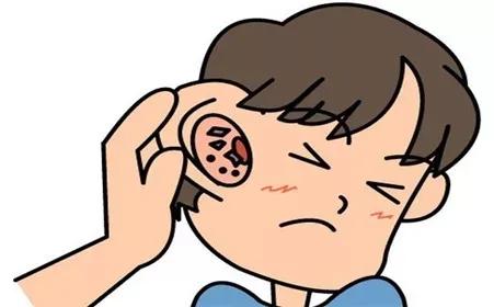 耳朵频繁发痒，可能是这4种病的表现，快看看是啥(图2)