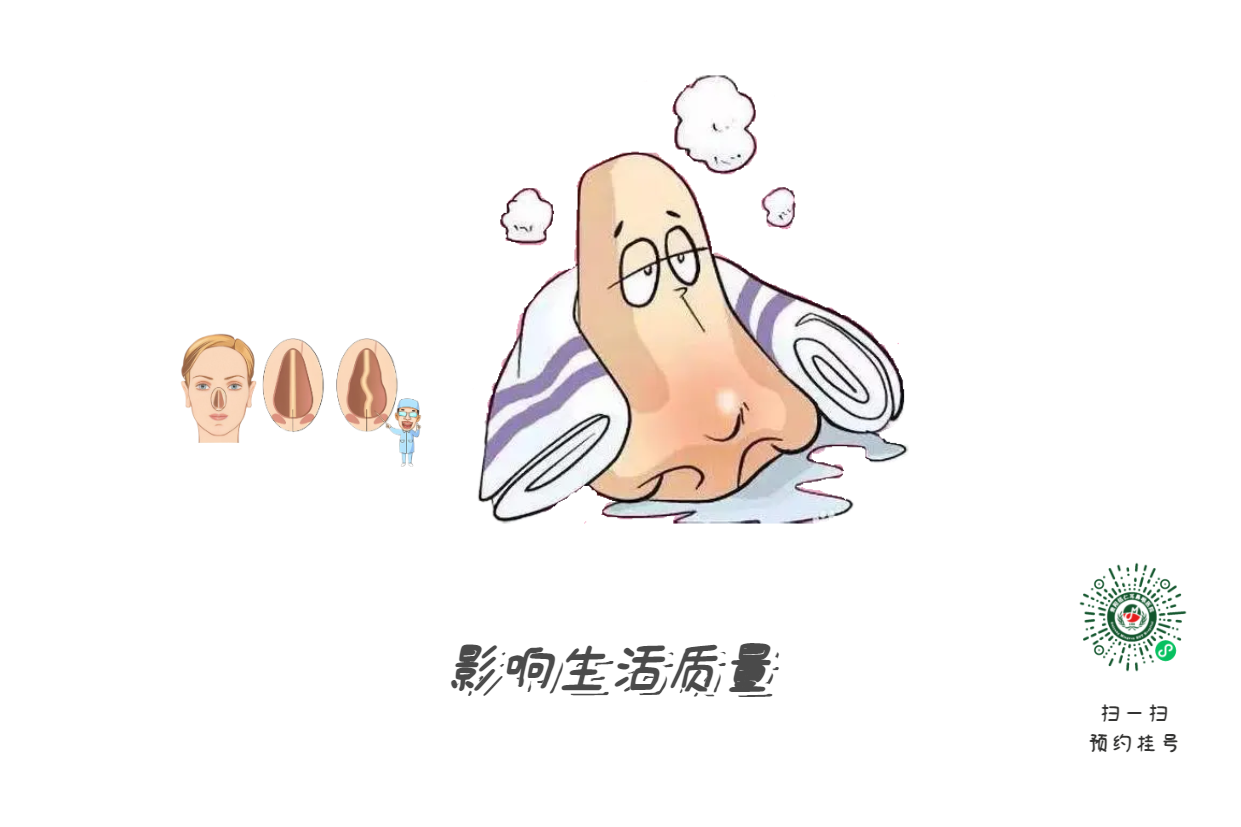 鼻塞、流涕、打喷嚏，是鼻炎引起的？注意可能是鼻中隔偏曲！(图2)