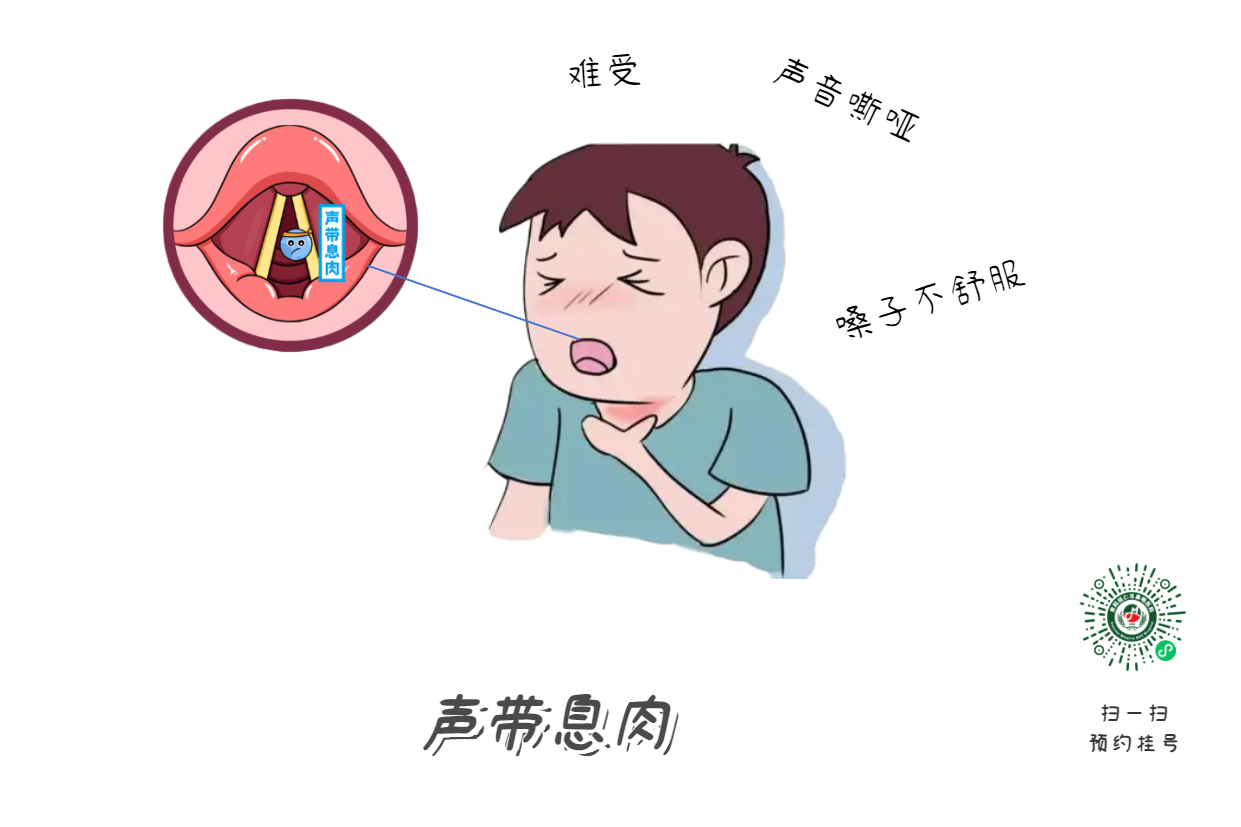 声音嘶哑，喉部不适怎么办？怎么预防？(图1)