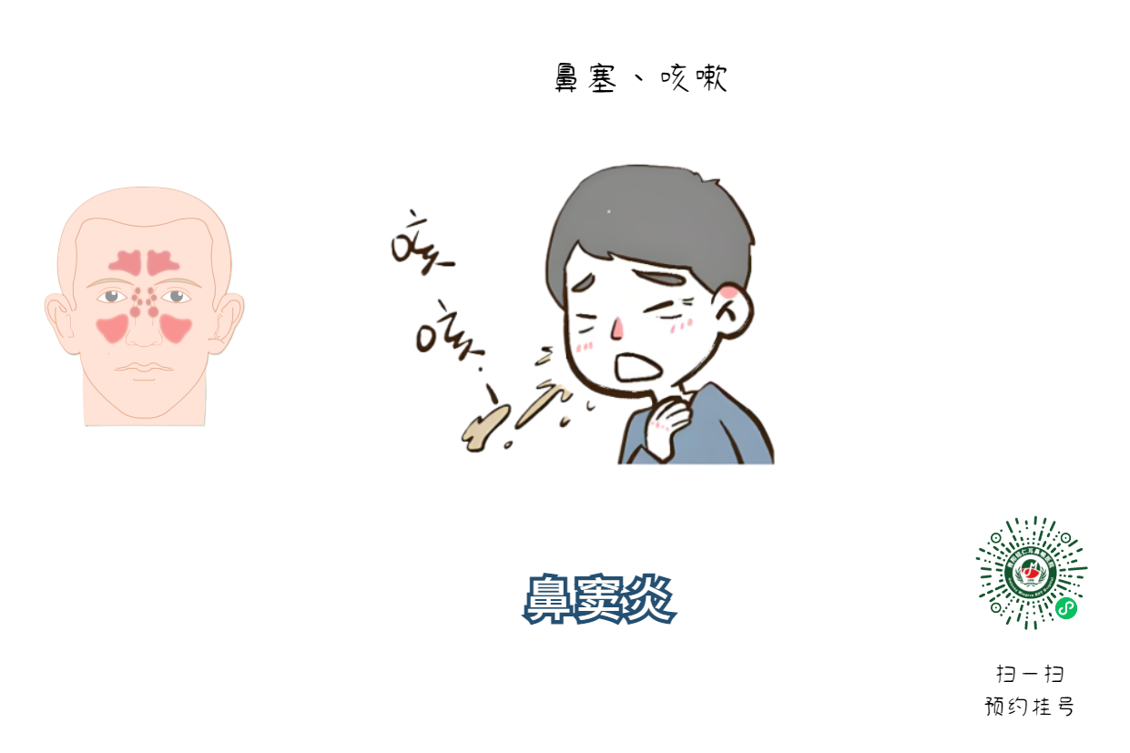 鼻炎、鼻窦炎傻傻分不清，两者该如何区分？(图2)