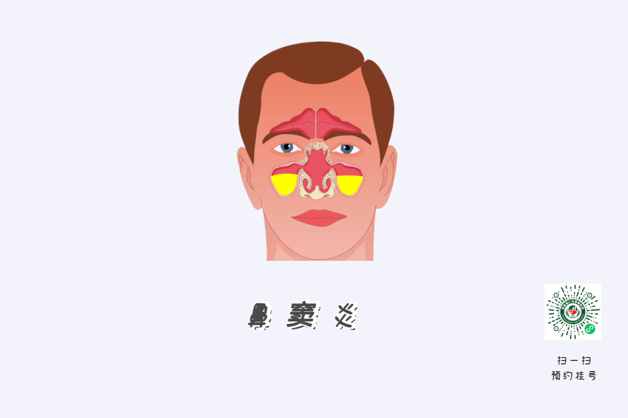 鼻窦炎头痛有特点！这个位置痛要当心(图1)