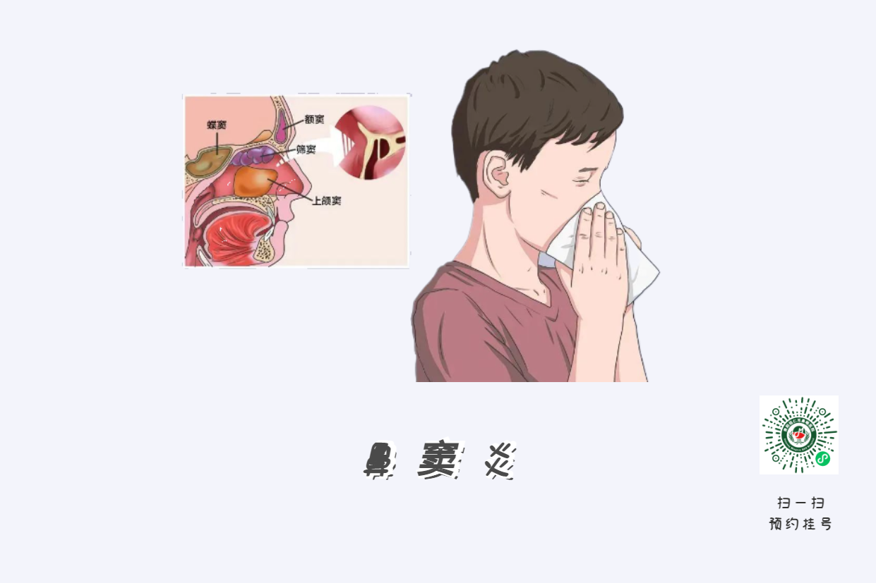 鼻窦炎头痛有特点！这个位置痛要当心(图3)