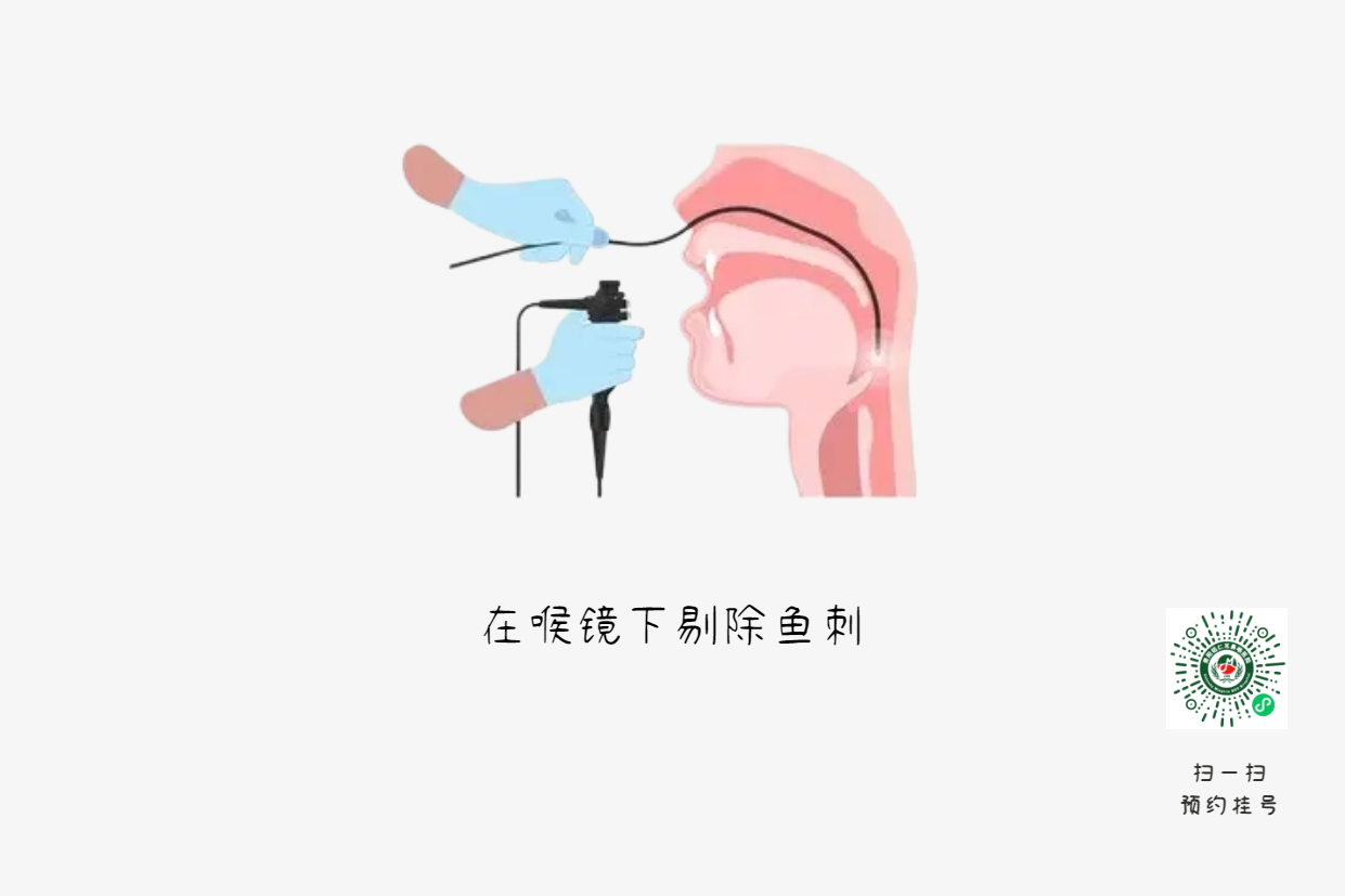 喉咙卡鱼刺？喝醋吞饭都是致命错误(图2)