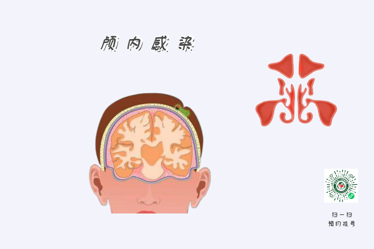 为什么患上鼻窦炎，会使孩子学习成绩下降？(图3)