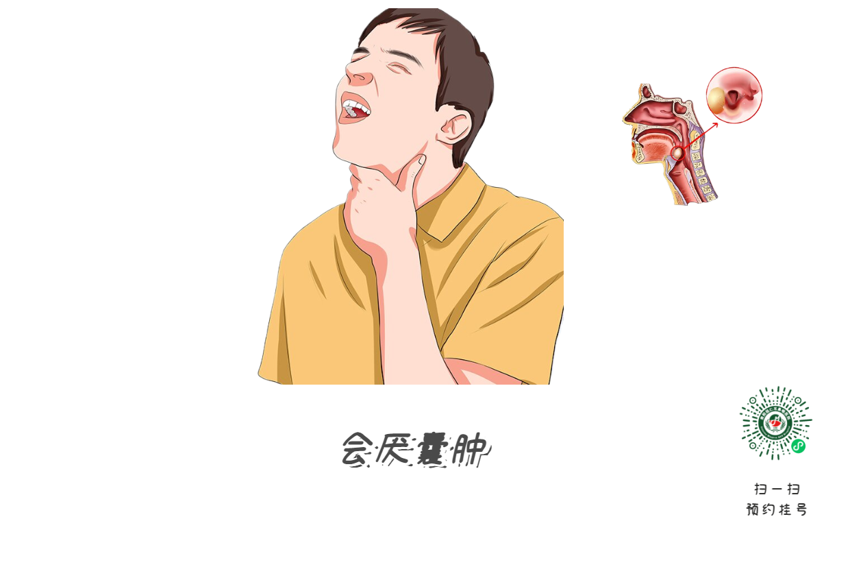 女子吃火锅后窒息，竟因忽视这个小囊肿(图2)