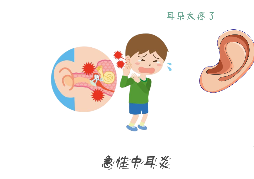 中耳炎拖成耳聋？3个危险信号别忽视(图1)