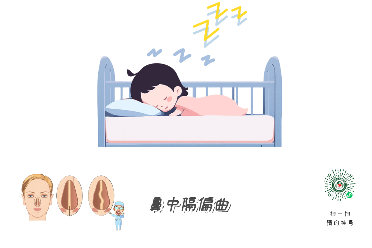 孩子打呼=睡得香？腺样体警报！(图3)