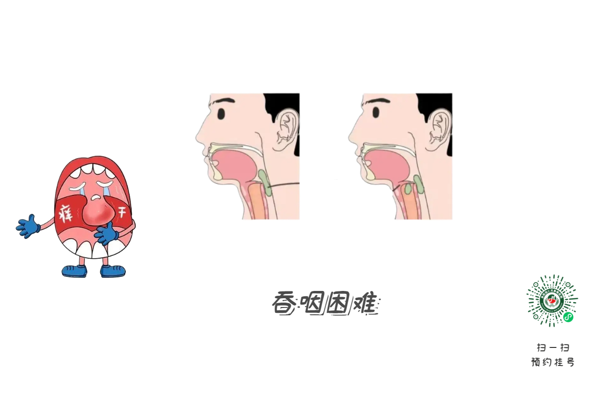 嗓子哑了别大意，可能是声带在“报警”(图2)
